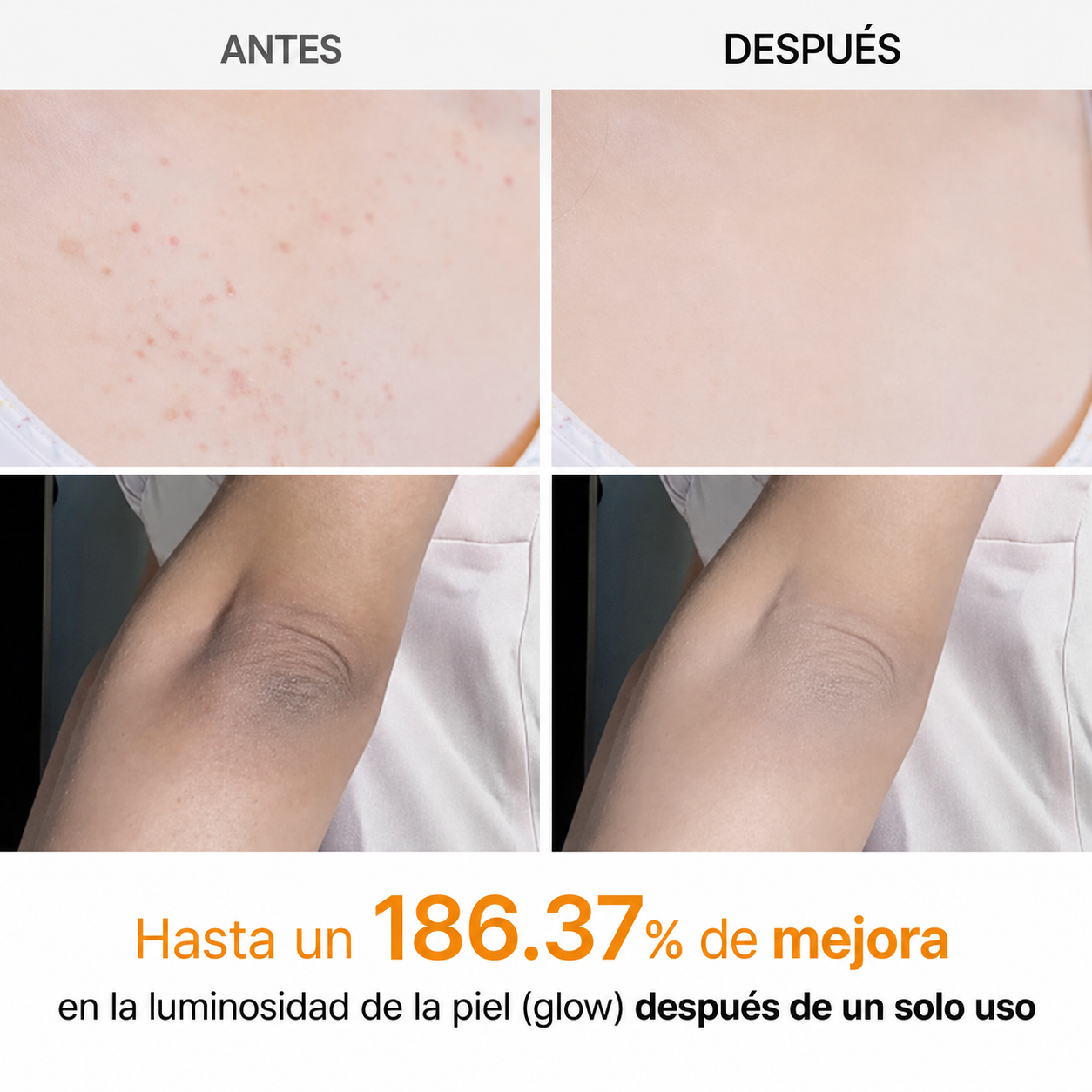 Dr. Melaxin® - Spray Exfoliante Corporal Peeling